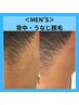 【メンズ脱毛】　うなじ・背中脱毛　2750円　ファッションも髪型もキマル！