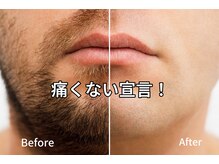 男のカラダビューティーの雰囲気（最新の「痛みが少ない」脱毛だから楽！フォトの光も同時で美肌。）