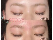 ストーリー(STORY)/眉毛と艶肌ワックス専門店