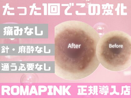 ライリー(Rairy)の写真