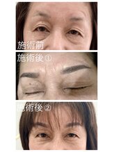 サイ(sai)/眉タトウー