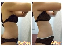 癒の浅草/痩身ビフォーアフター　浅草店