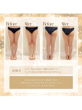 美容整骨小顔ラボ/痩身ビフォーアフター