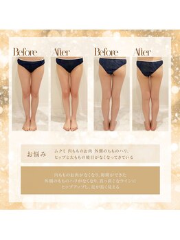 美容整骨小顔ラボ/痩身ビフォーアフター