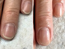 ネイルルーム エンヌ(nail room en'ne)/ネイルケアで自爪育成♪