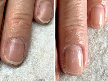 ネイルケアで自爪育成♪