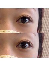 フィービー(pheebe)/ラッシュリフト