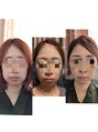 トリニティスペース(TrinitySpace) 脂肪分解レモンボトルのビフォーアフターは私を見て頂きたい!