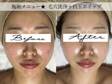クラッシー(Classy)の雰囲気（赤み、敏感肌、ニキビケア、どんなお悩みもお任せください）