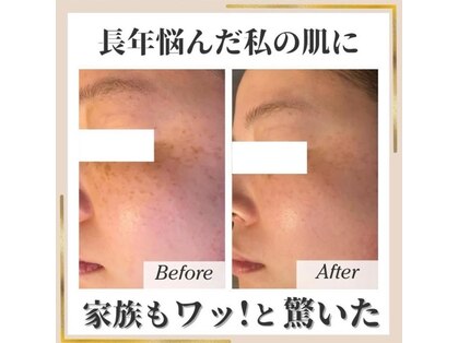 ココ(KOKO)の写真