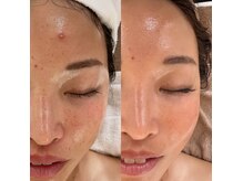 コモア(COMOA)の雰囲気（お肌のあらゆるお悩みに、【幹細胞上清液】で根本改善！）