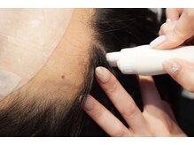 ベルフィーヌ 桐生店(BELFINE)/ハイドロスプラッシュ