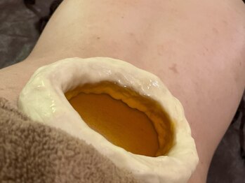 アーシャ(Aasha)/アーユルヴェーダ★