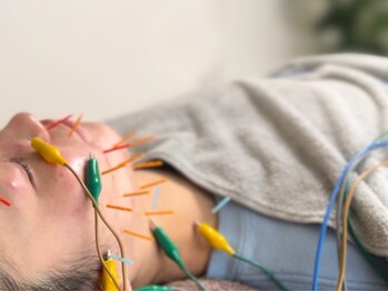 耀 カガヤキ/電気を使った美容鍼