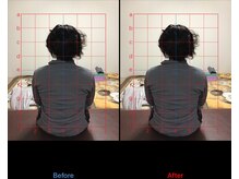 ストレチックス 近江八幡店/首・肩・腰に痛みがあった男性