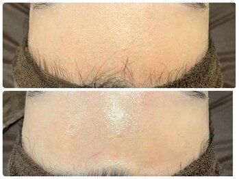 ブリリアント(Brilliant)/本格シェービング