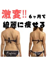 サロン ド ボーテ ラーンジュ 岐阜店(salon de beaut'e L'ange)/ハイパ-ナイフEX2ダイエット痩身