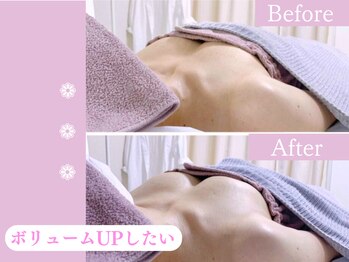 キアナ 横浜店(Kiana)/バストアップBefore After