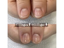 ネイルサロン ユーズ(USE.)/最強のネイルケア/自爪育成