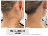 【ご新規様割】うなじ美人＊レディースうなじ脱毛￥4000→￥2000