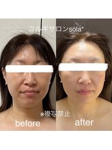 ソラ(sola*)/年齢によるお悩みも撃退