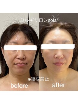 ソラ(sola*)/年齢によるお悩みも撃退