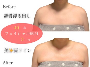 アルピナ(ALPINA)/ウルトランスフォーマー