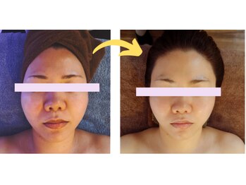 エステティックシトラス(esthetic CITRUS)/before & after