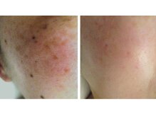 サロンドエステケイワイ(de KY)