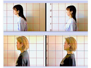 からだラボ イエロー(YELLOW)/施術前後の比較