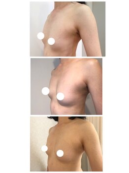 フラフィ 宇都宮本店(fluffy)/お客様症例☆30代