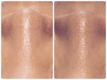 ベルドア(Bell Door)/皮脂／角栓／黒ずみ毛穴