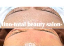 リノ トータルビューティサロン(lino total beauty salon)/フェイシャル・WAX脱毛