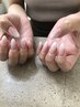 【HAND】《パラジェル》シンプル定額コース7000円