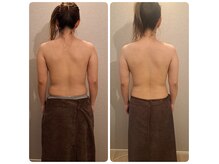 ライフプラス(Life Plus)の雰囲気（筋膜リリースで2回の施術です）