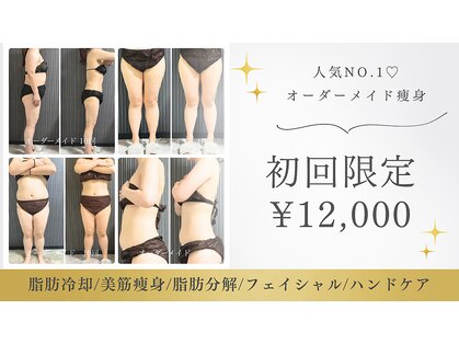ディベル(DEBEL)の写真