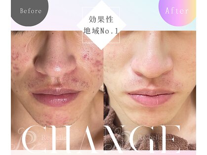 メンズミーシェ(Men's Meshie)の写真