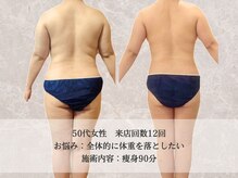 エクストリミティ 国立店(EXTREMITY)/お客様の変化