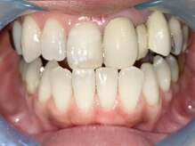 ミレホワイト(Mirae White)