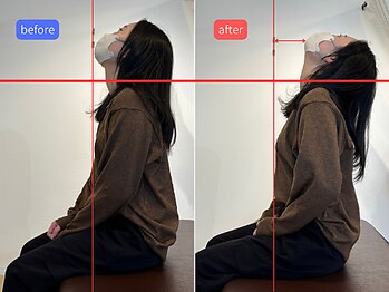 エスリー整骨院(SSS整骨院)/肩こり、頭痛、可動域改善!