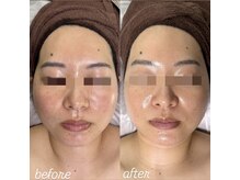 アンベリール(Embellir)/Embellir