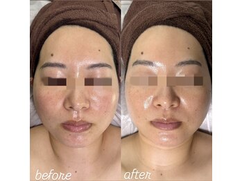 アンベリール(Embellir)/Embellir