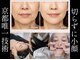 サロンチオリ 烏丸(Salon Chiori)の写真/糸リフトを考える前に！京都唯一の【口内筋アプローチ】内側からアイロンをかけたような若ハリ肌＆小顔へ