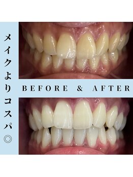 ドルチェ 水戸店(Dolce)/★ before → after ★