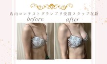 エステティックレイビス 弘前店(RAYVIS)