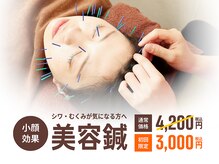 三国はら鍼灸整骨院/美容鍼