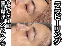 ベル 南船場店(Belle)/シワケアもおススメ☆ララピール