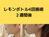 ◆レモンボトル2cc◆フェイスラインの脂肪スッキリ小顔に！横顔美人¥14500→