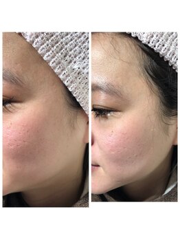 すっぴん美肌革命/毛穴の目立たないなめらか肌へ