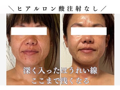 スロウ(SLOW.)の写真